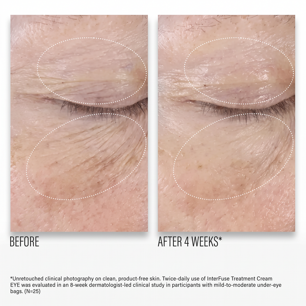 Shop Rescue Spa InterFuse Treatment Cream EYE before and after showing reduced wrinkles and smoother under-eye skin