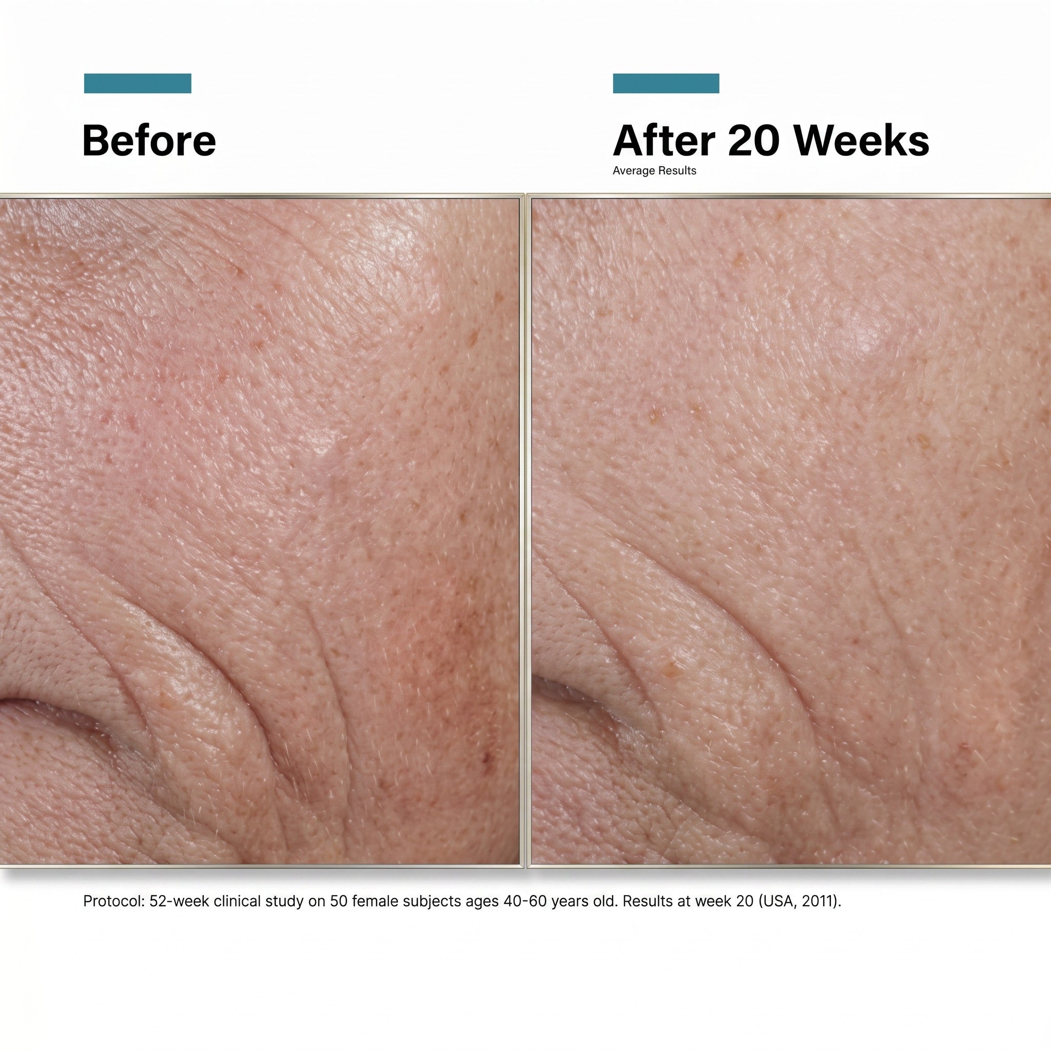 Shop Rescue Spa C E Ferulic before and after results showing reduced fine lines and improved skin texture after 20 weeks