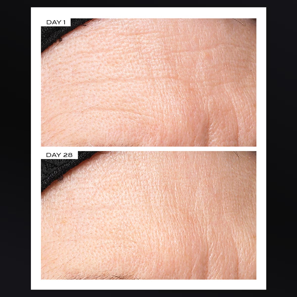Shop Rescue Spa 111SKIN Exosome Face Lift before and after results showing reduced forehead wrinkles after 28 days