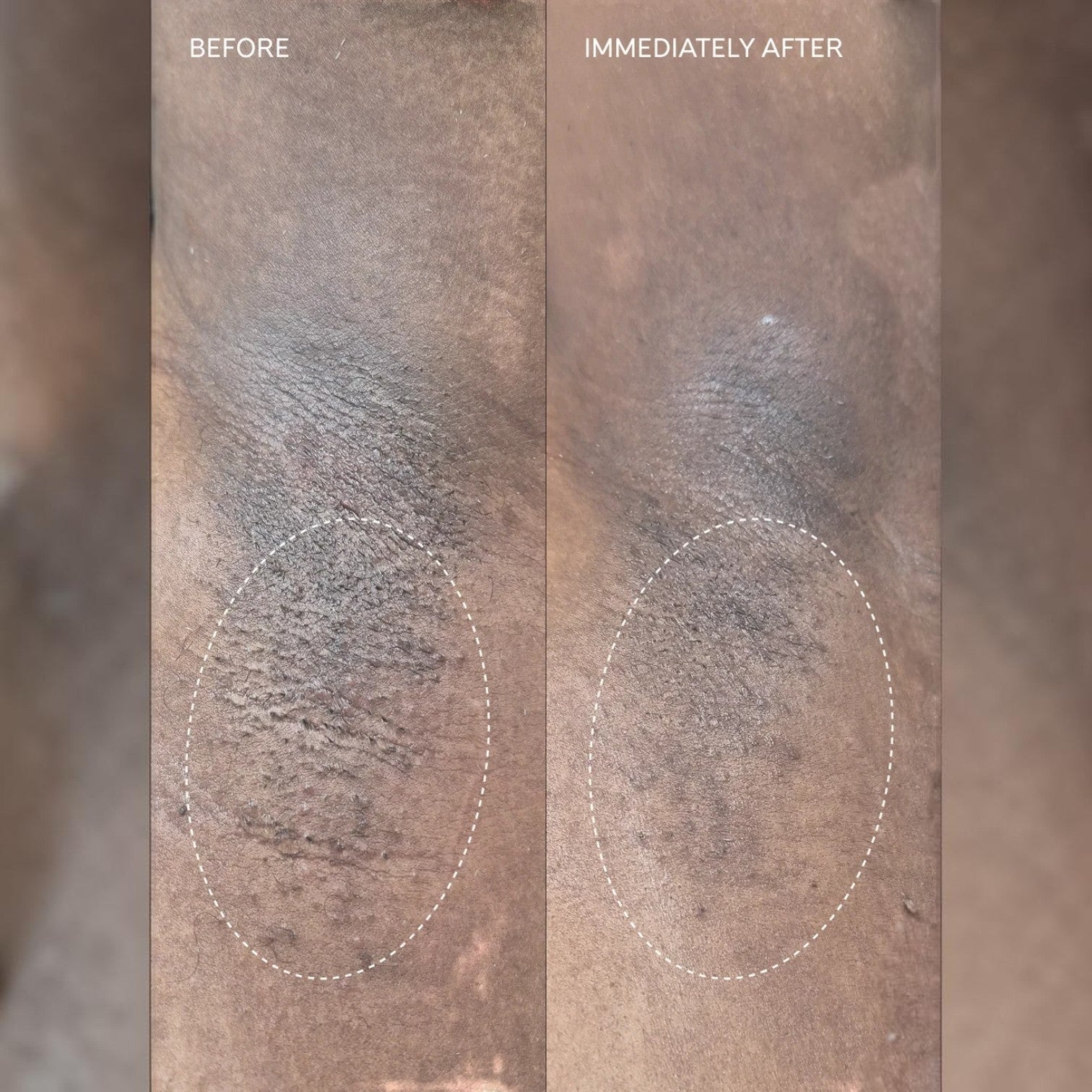 Shop Rescue Spa Flash Repair Jelly before and after treatment showing reduced skin irritation and redness on underarm