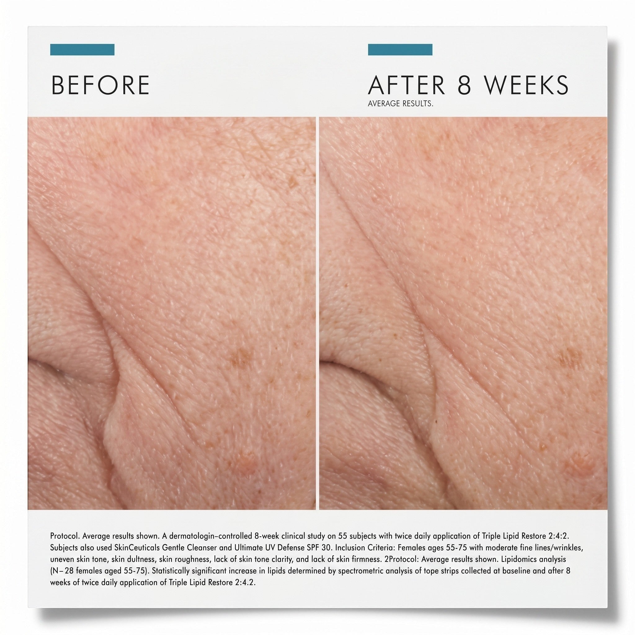 Shop Rescue Spa Triple Lipid Restore 2:4:2 before and after 8 weeks of use showing improved skin texture and radiance