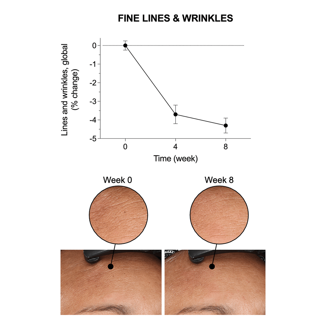 Elasticity Reinforcing Lipid-Cream