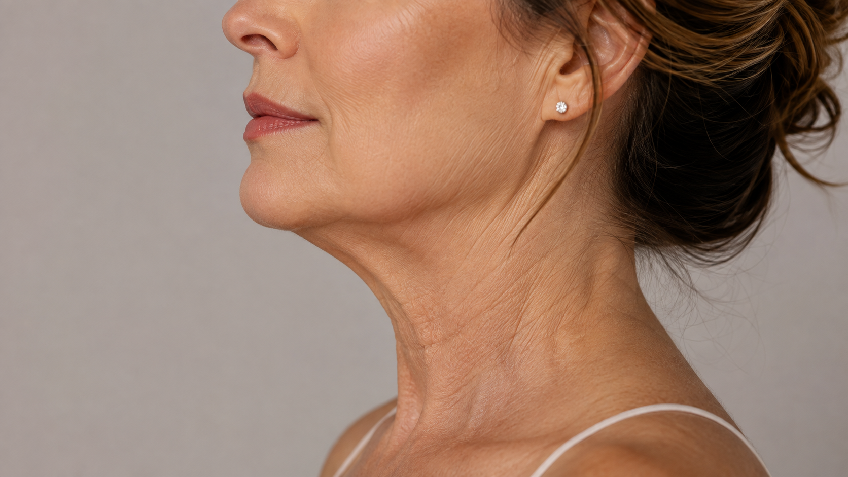 Turkey Neck and a Sagging Jawline: How to Firm the Lower Face and Neck