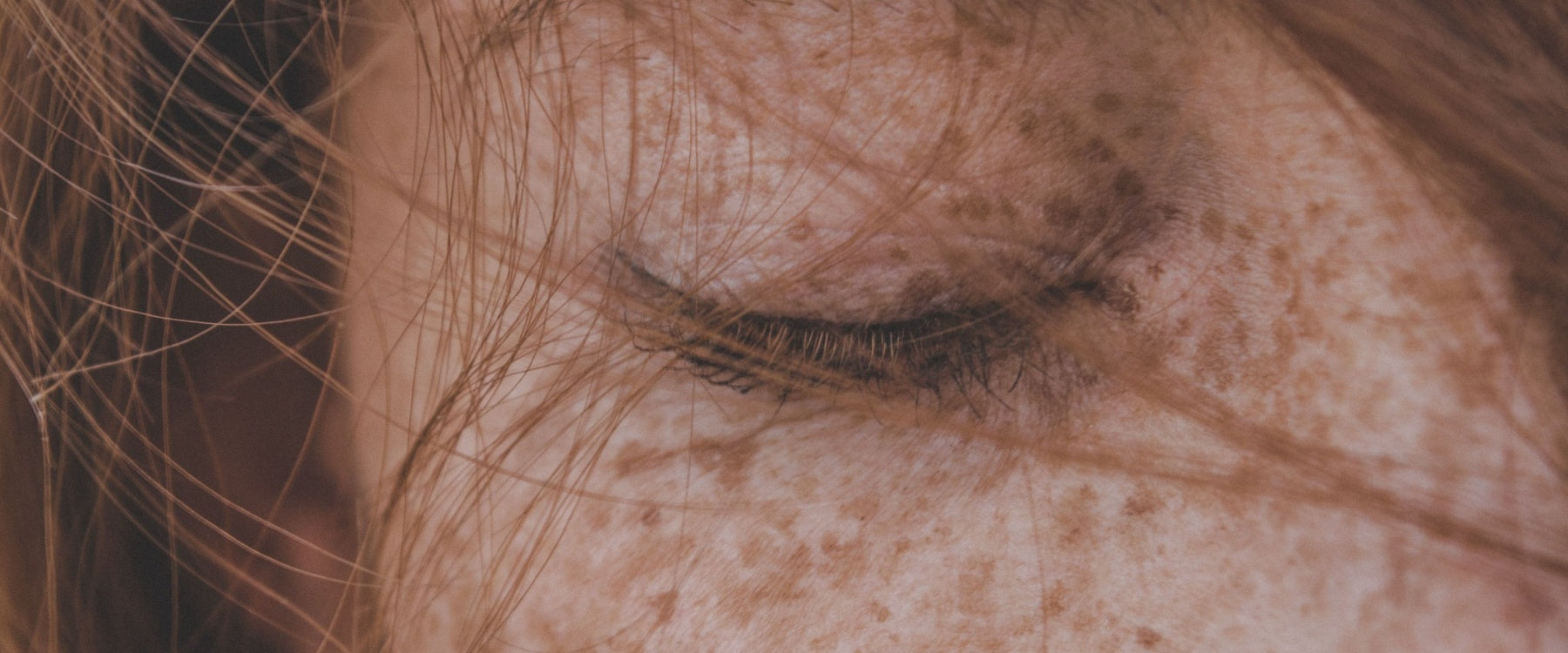 Sun Spots vs. Freckles