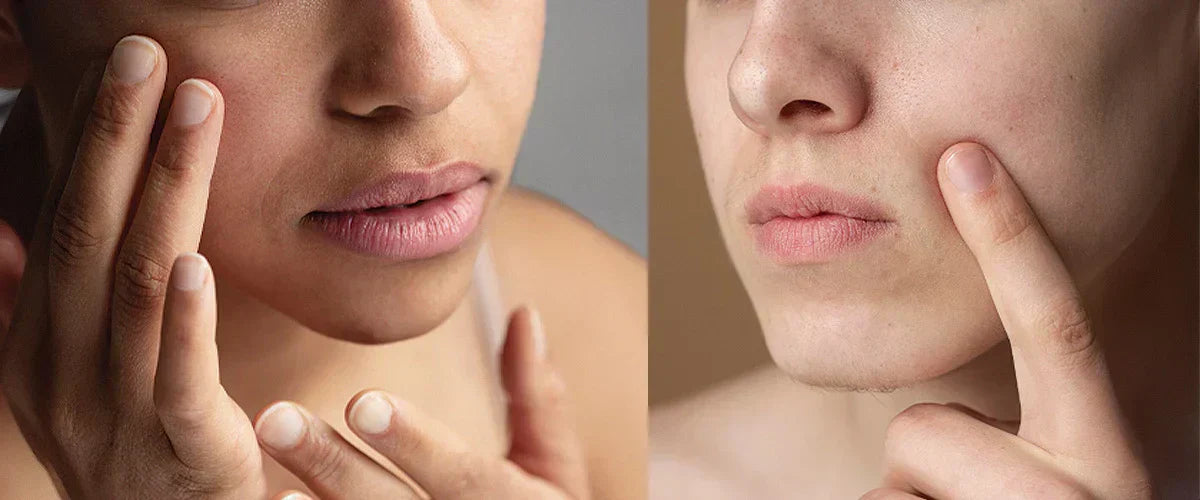 What Dehydrated Skin Actually Looks Like (It’s Not Dry)