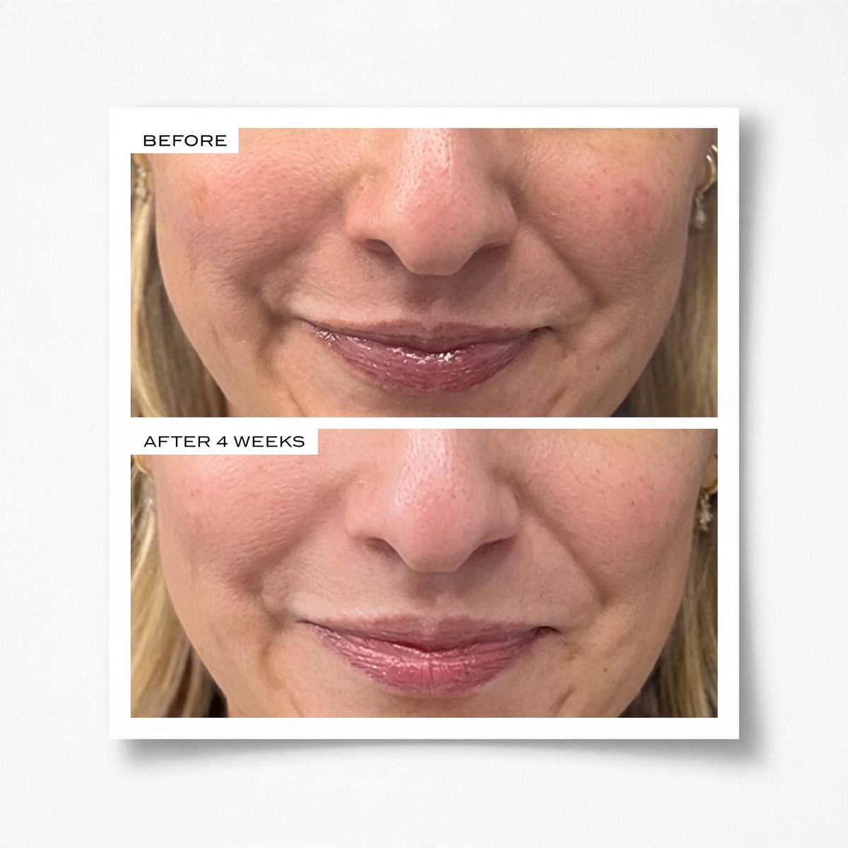 Precision Peel