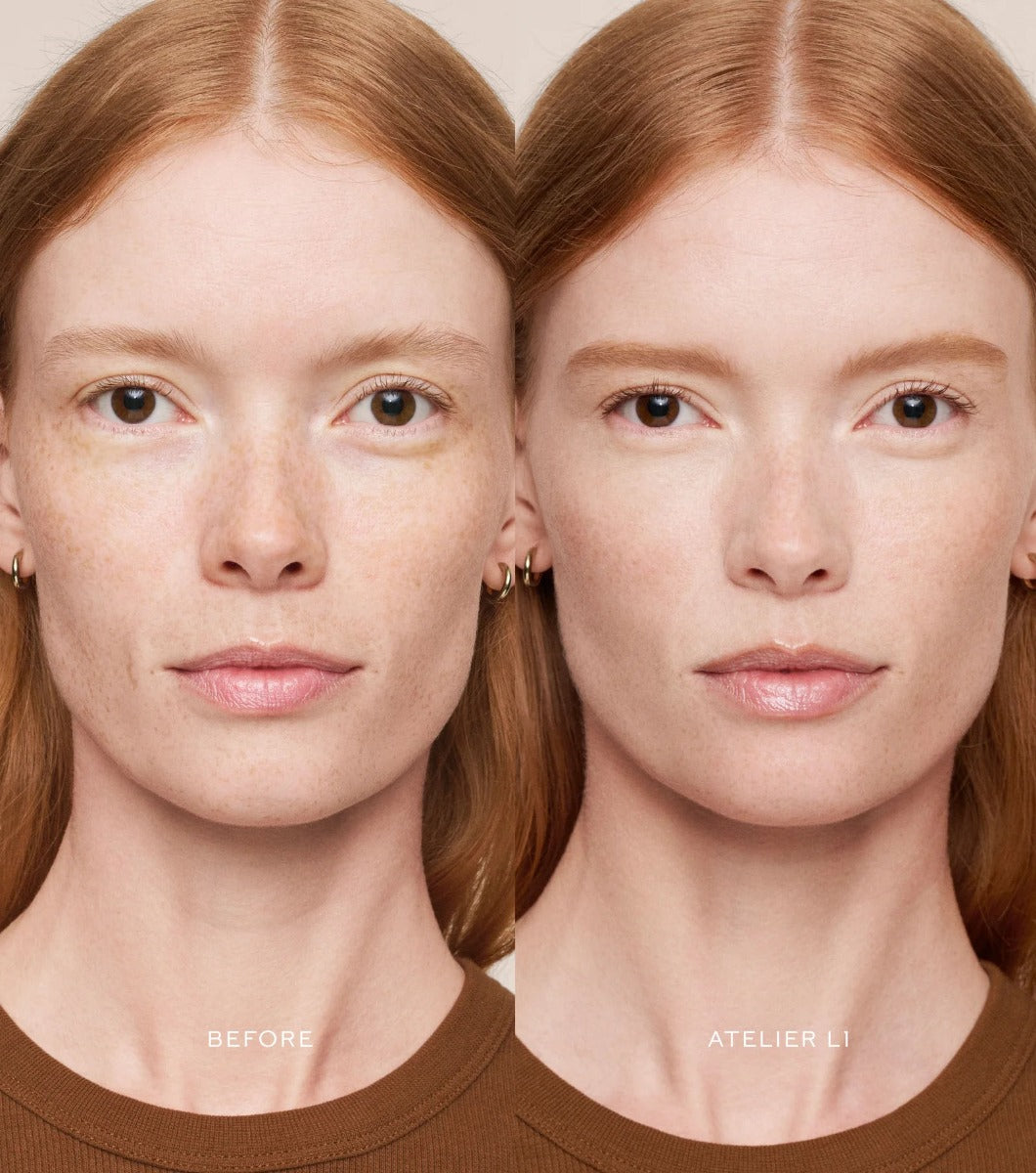 Vital Skincare Concealer