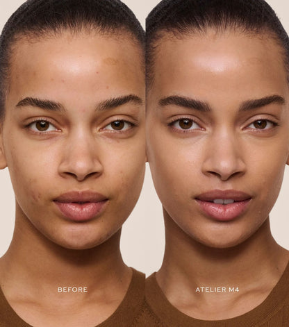 Vital Skincare Concealer