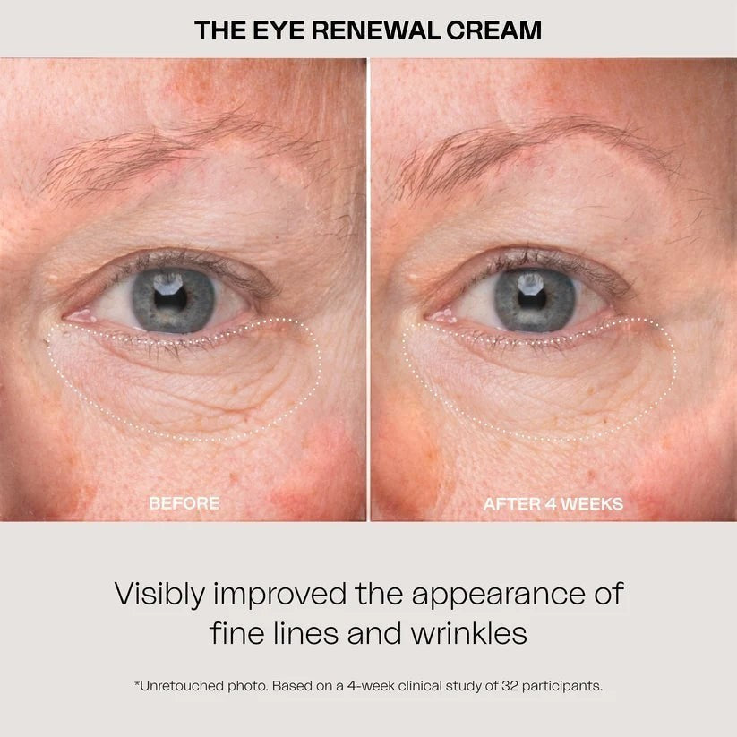 The Eye Renewal Cream