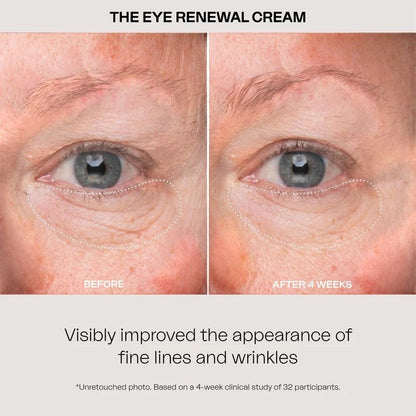 The Eye Renewal Cream