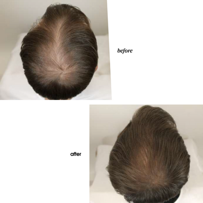 Extreme Caviar Revitalizing Exosomicshot Scalp Concentrate