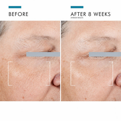 Shop Rescue Spa A.G.E. Advanced Eye before and after results showing reduced crow&