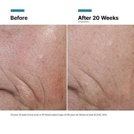 Shop Rescue Spa C E Ferulic clinical before and after results showing reduced fine lines and improved skin texture