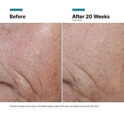 Shop Rescue Spa C E Ferulic clinical before and after results showing reduced fine lines and improved skin texture