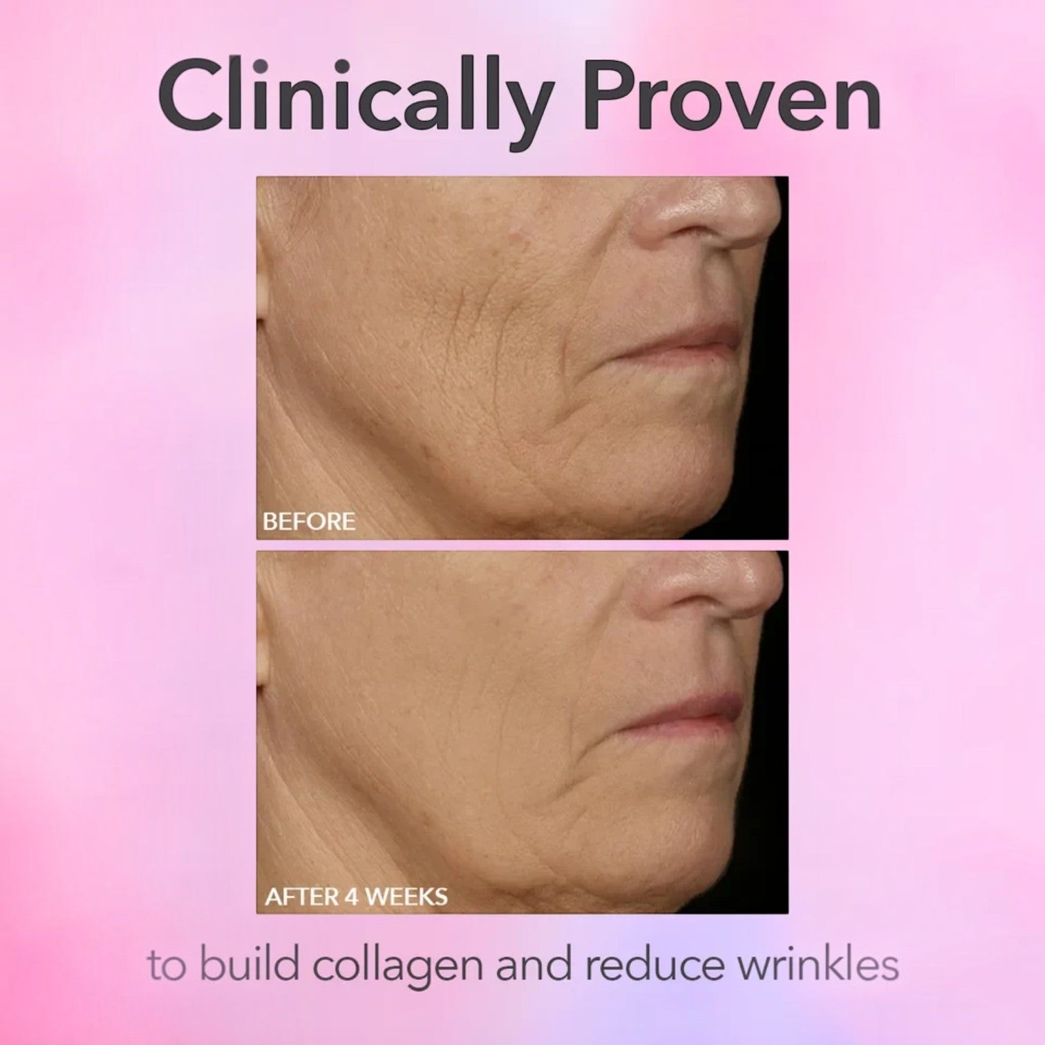Dr Dennis Gross Skincare | DRx SpectraLite FaceWare Pro | Shop