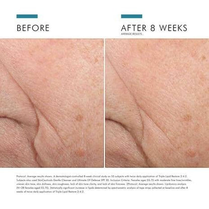 Shop Rescue Spa Triple Lipid Restore 2:4:2 before and after 8 weeks showing improved skin texture and reduced wrinkles