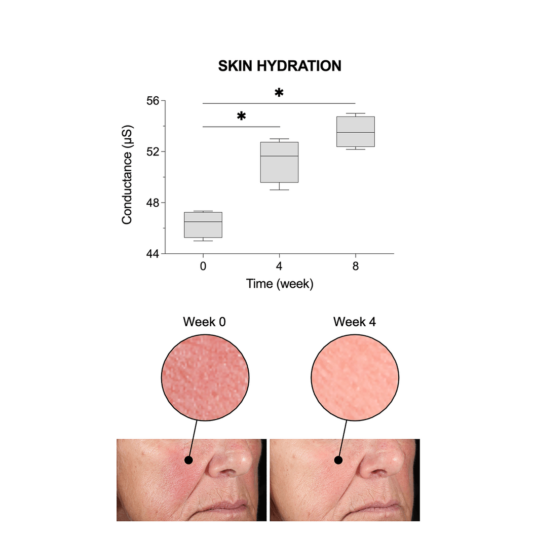 Elasticity Reinforcing Hydra-Cream