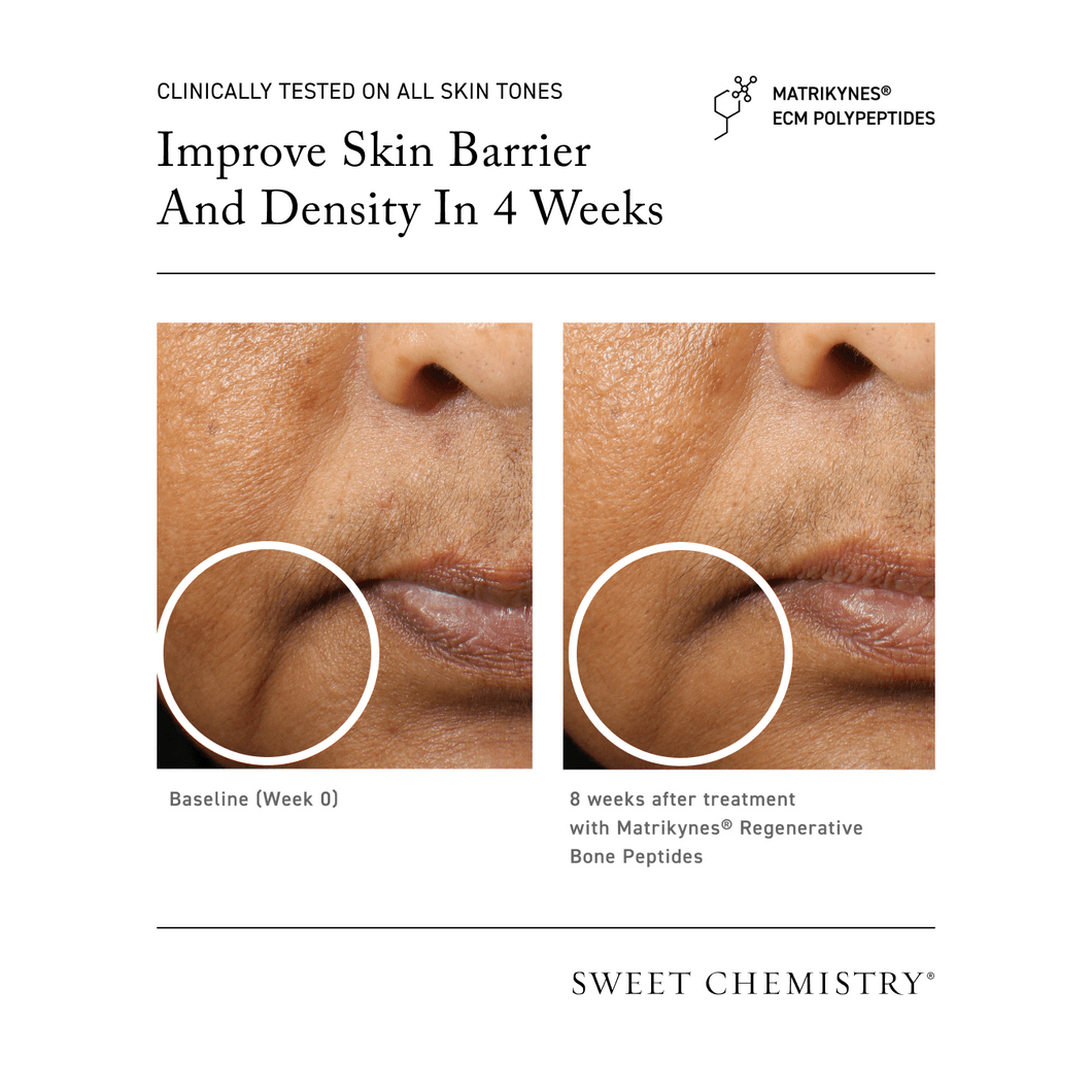 Elasticity Reinforcing Lipid-Cream