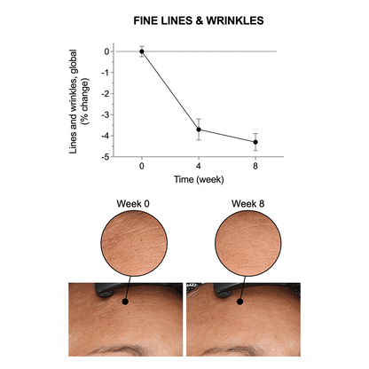 Elasticity Reinforcing Lipid-Cream